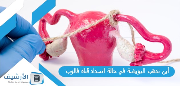 تذهب البويضة في حالة انسداد قناة فالوب