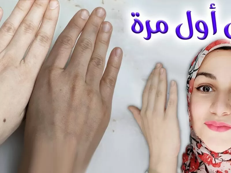 هاتيه قبل ما يخلص كريم من الصيدلية لتفتيح البشرة