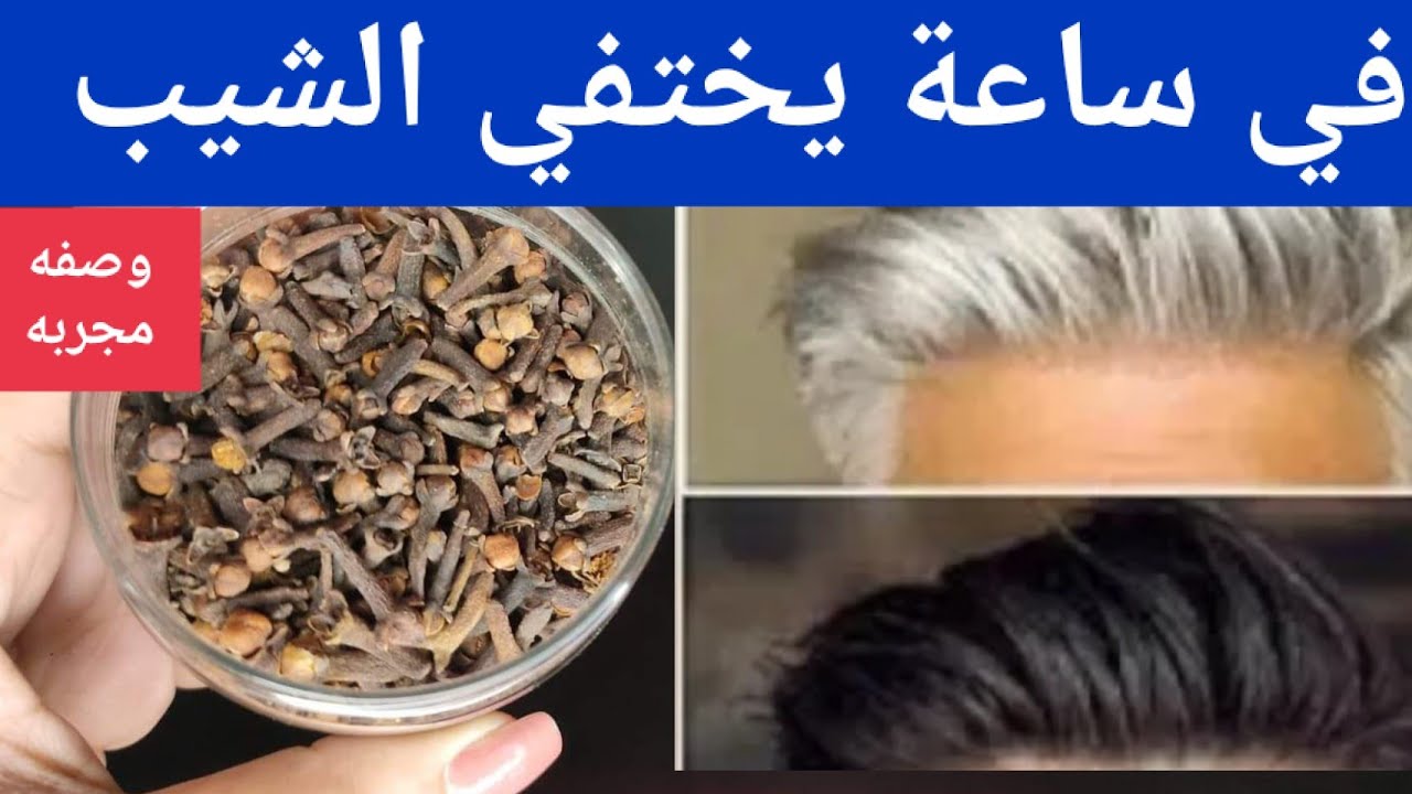 القرنفل للتخلص من الشيب بوصفة سحرية بدون صبغة ولا