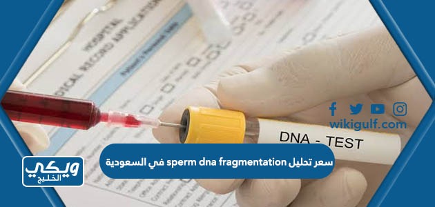 تحليل Sperm Dna Fragmentation في السعودية