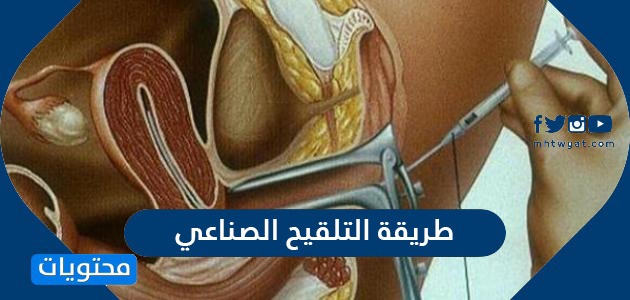 التلقيح الصناعي وما هي الممنوعات بعد التلقيح الصناعي