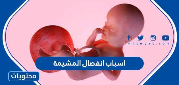 هي اسباب انفصال المشيمة