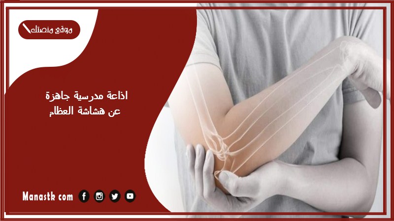 مدرسية جاهزة عن هشاشة العظام كاملة الفقرات بالمقدمة والخاتمة