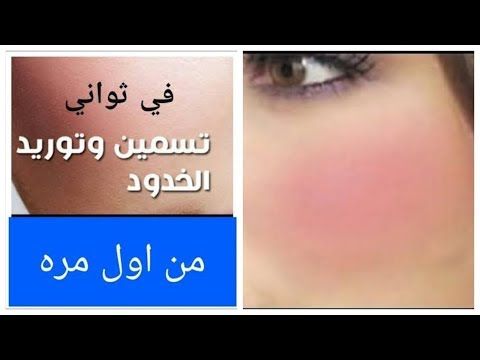 واقوي بوتوكس طبيعي لنفخ الخدود وتسمين الوجه من أول