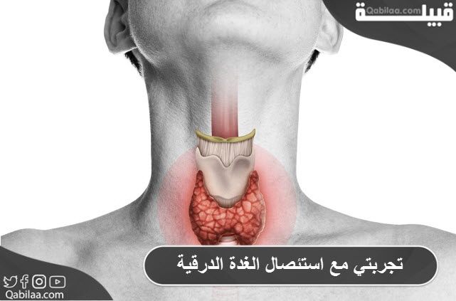 مع استئصال الغدة الدرقية