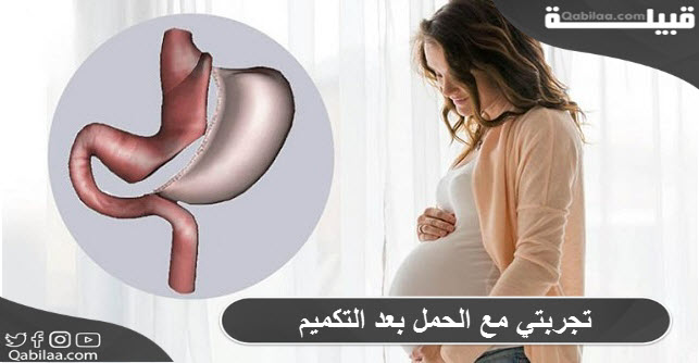 مع الحمل بعد التكميم