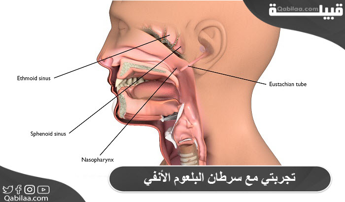 مع سرطان البلعوم الأنفي