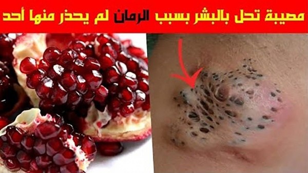 جدا كارثة صحية بسبب الرمان لم ينتبه لها أحد